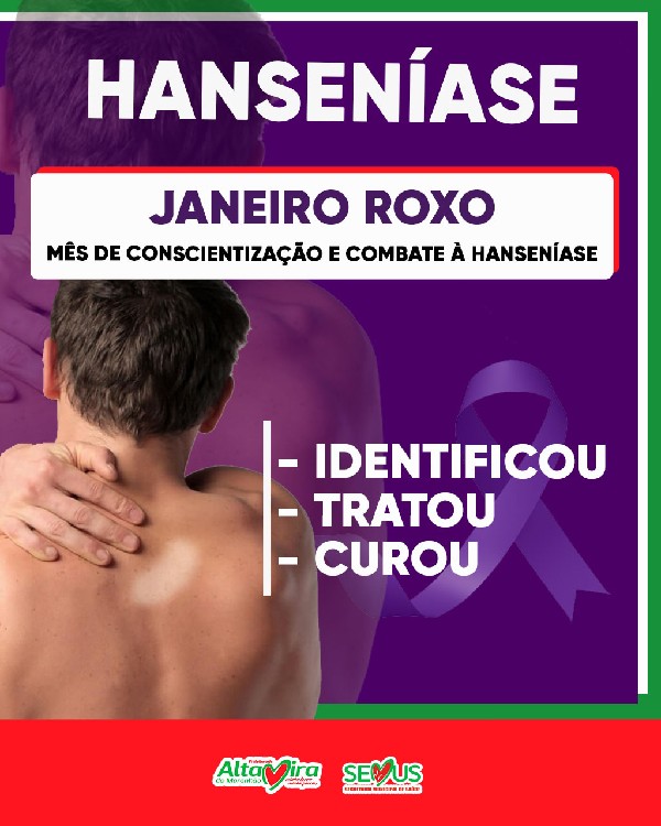JANEIRO ROXO - MÊS DA CONSCIENTIZAÇÃO E COMBATE À HANSENÍASE.
